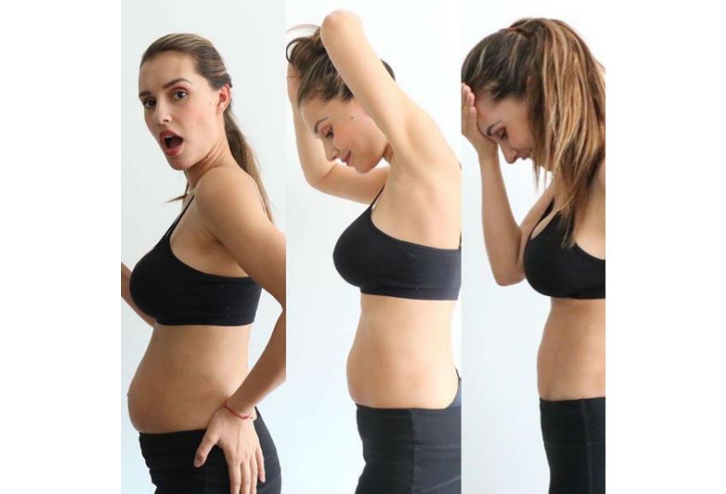 María Clara Rodríguez sufre de Diástasis abdominal