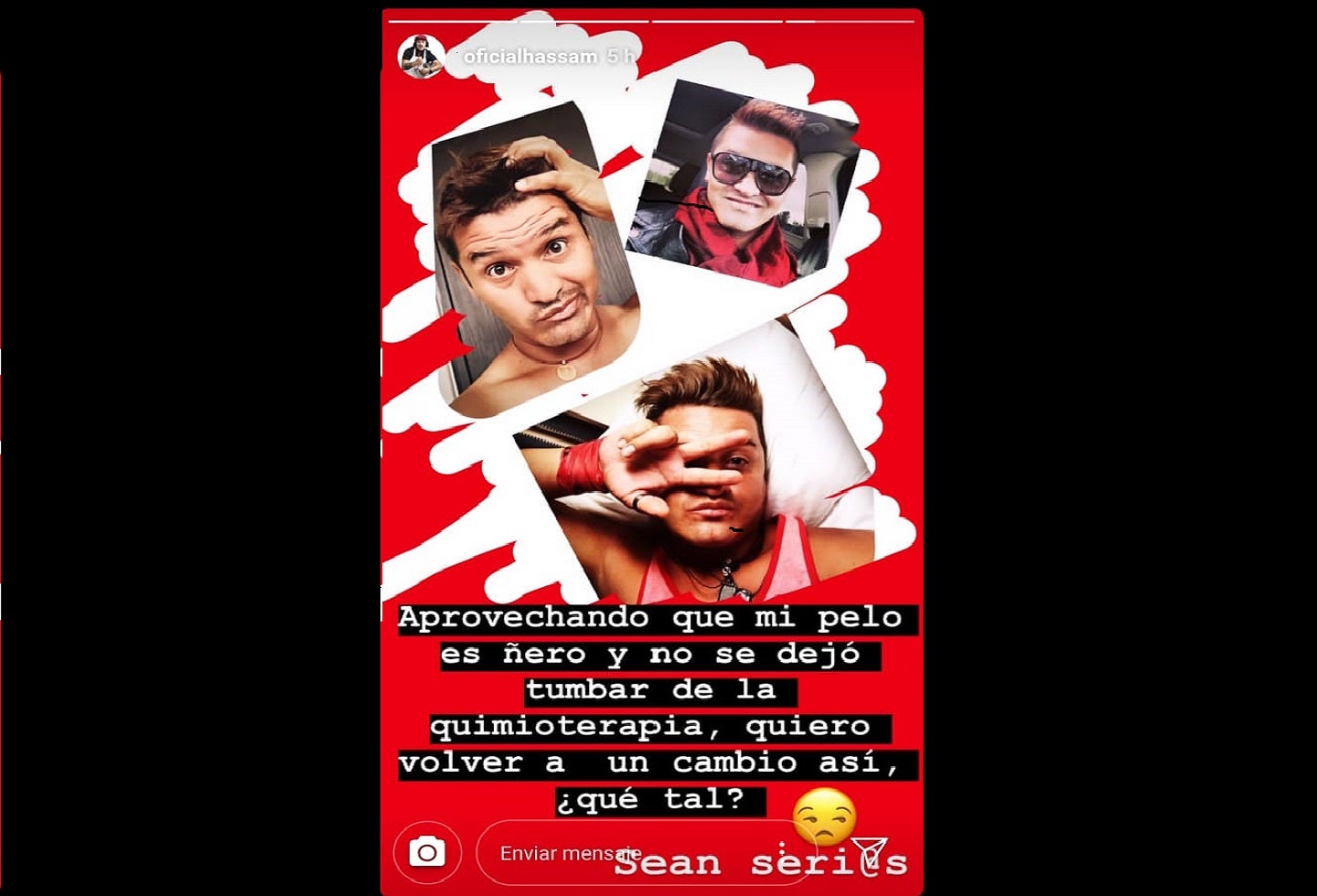 ¿Cómo le quedó a Hassam su cabellera después de la quimioterapia?