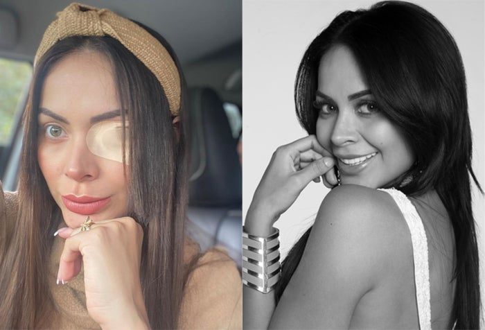 Laura González Díaz y el problema con su ojo