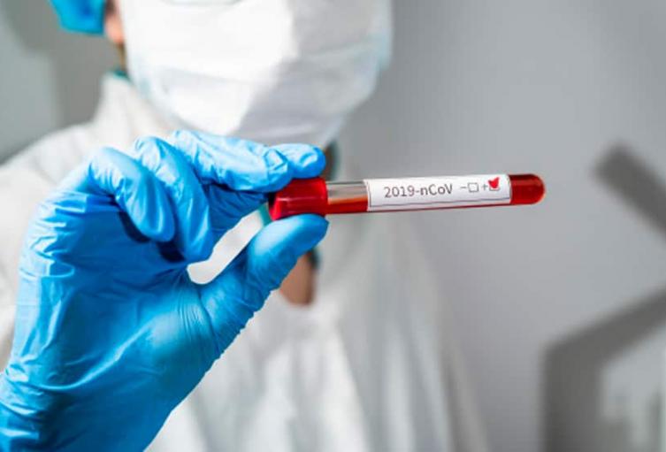 Prueba de coronavirus