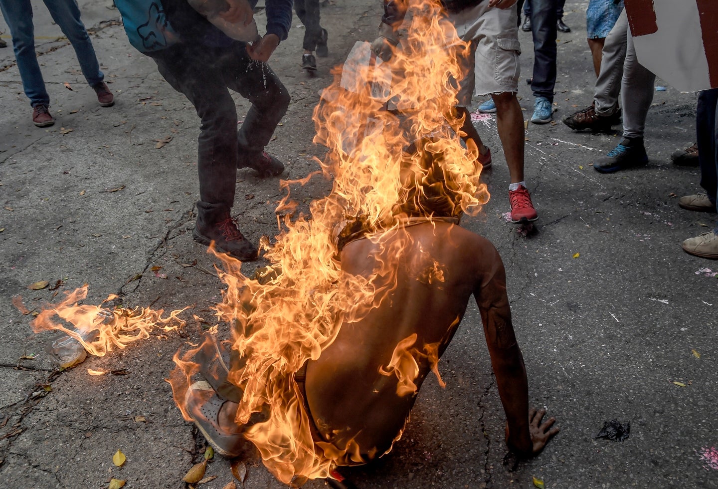 Manifestantes quemados en Venezuela