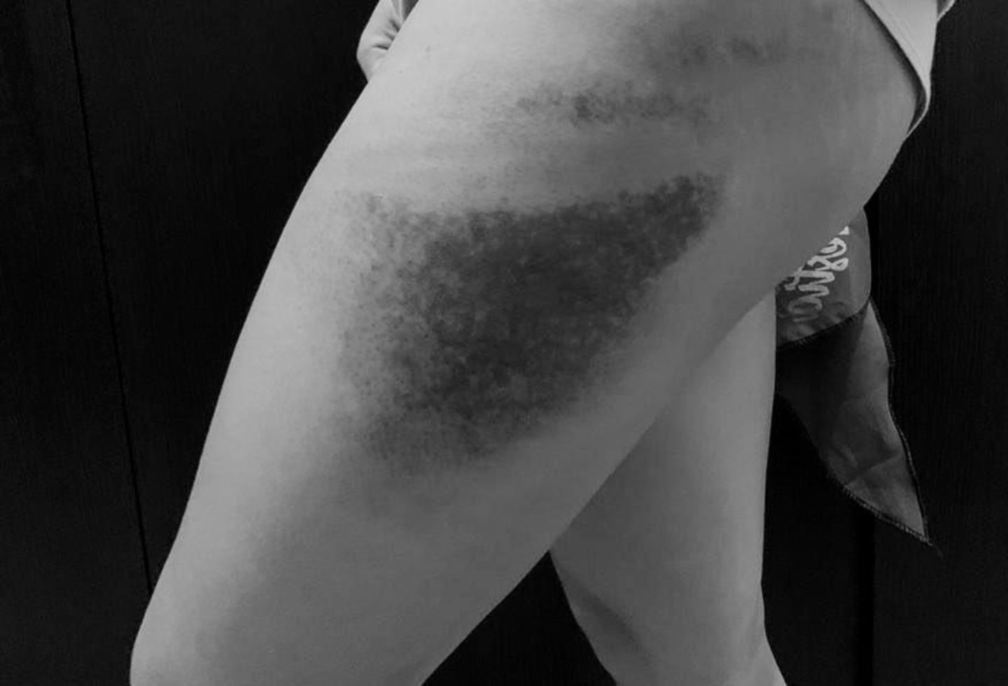 Golpes a mujeres tras piropos ofensivos