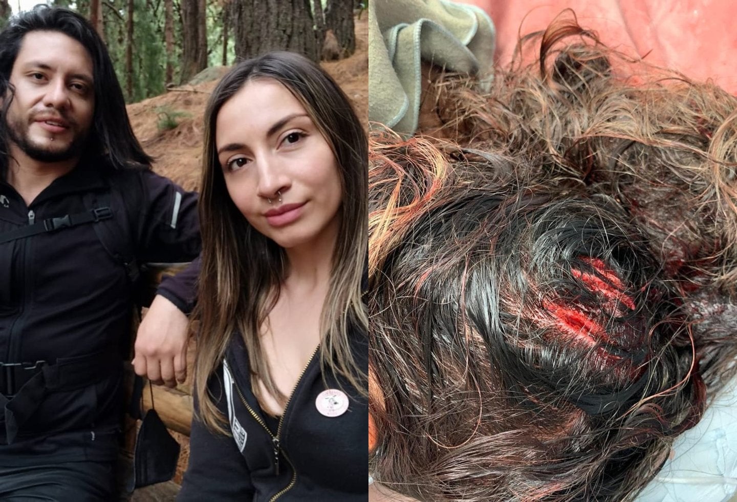 Delante de su hijo, celoso atacó con un hacha en la cabeza a su pareja