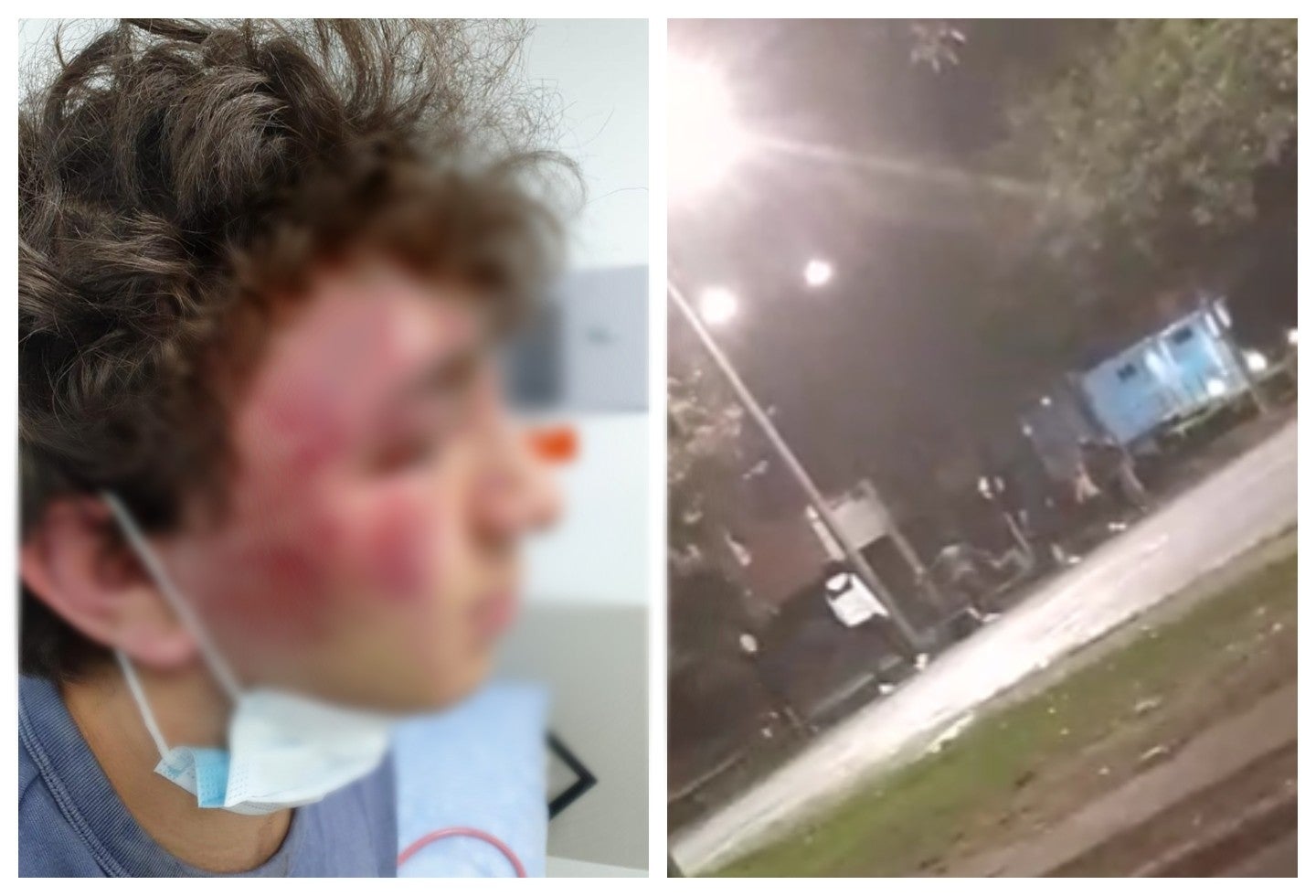 Golpiza a menor en Suba