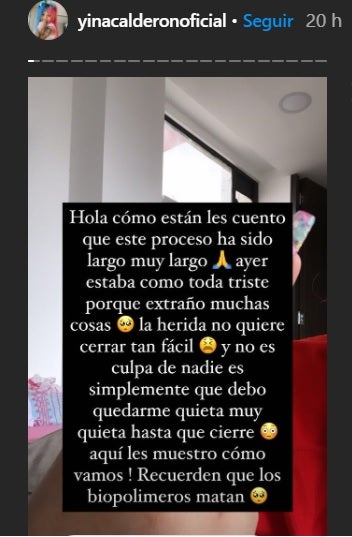 Cirugía a Yina Calderón