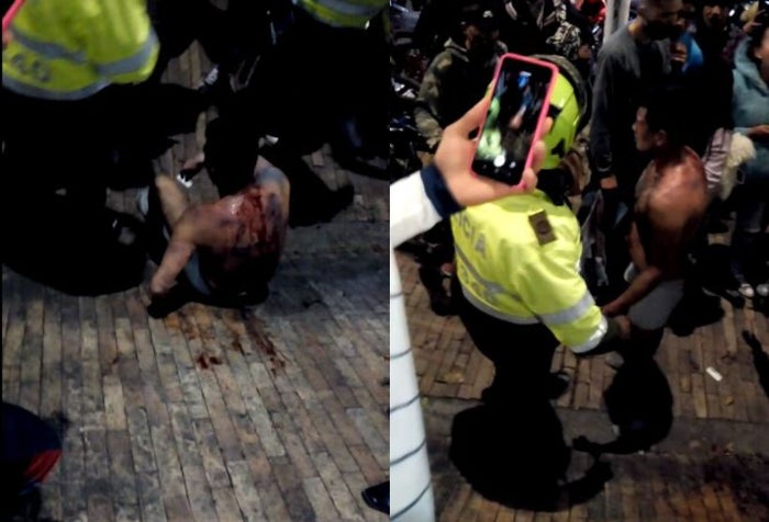 Paloterapia para ratero en Bosa que le rompió la cabeza a una señora