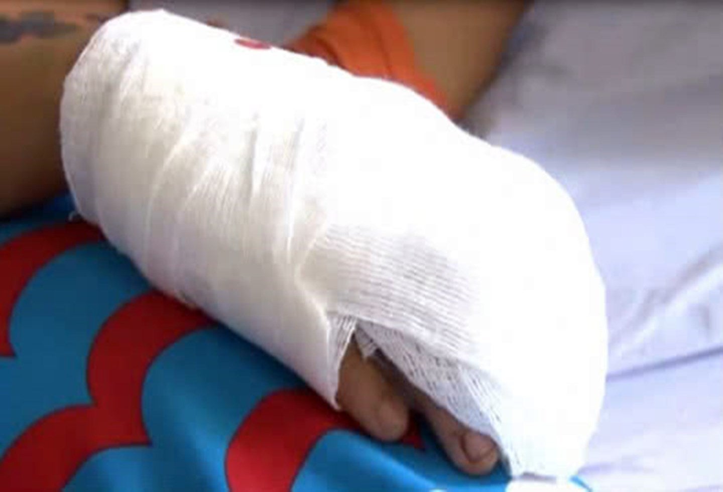 Quemados con pólvora.