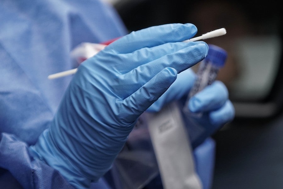 Prueba de coronavirus