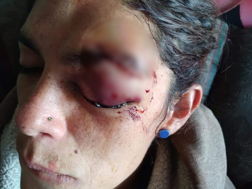 Mujer es agredida por acosador