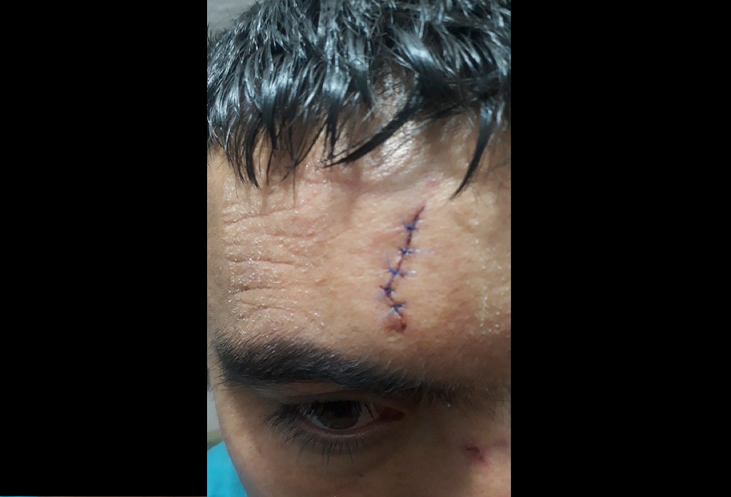 Taxista apuñalado en Bogotá