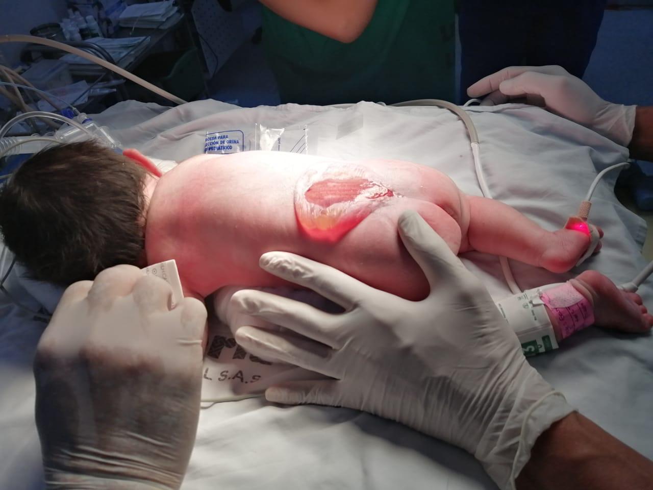 Bebé con malformación