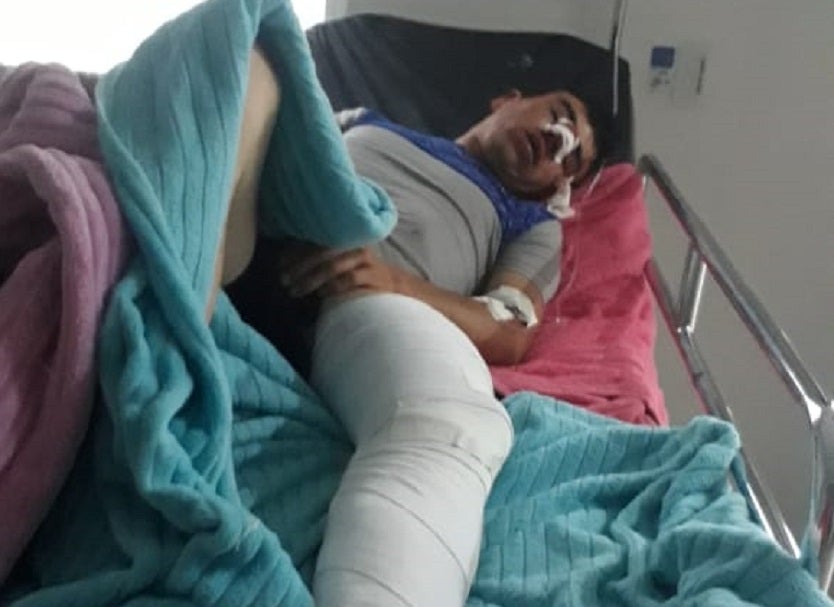 Joven arrollado por motociclista