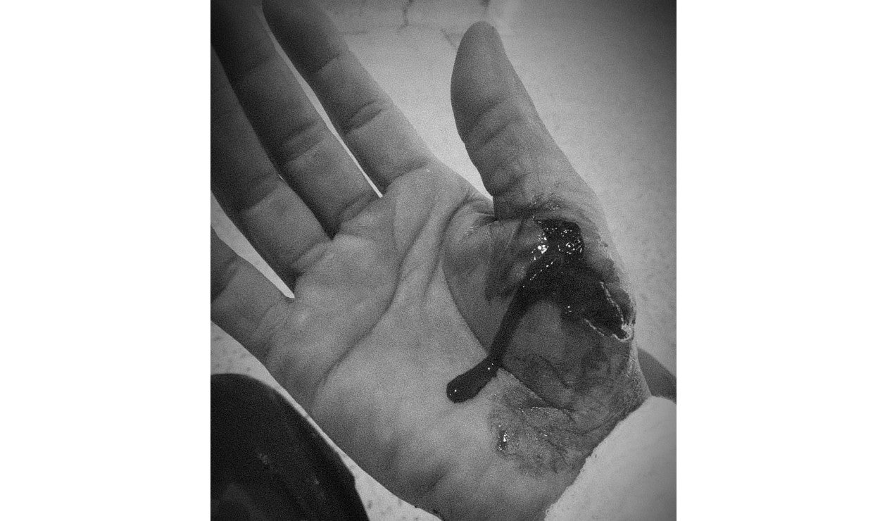 Conductor de SITP herido