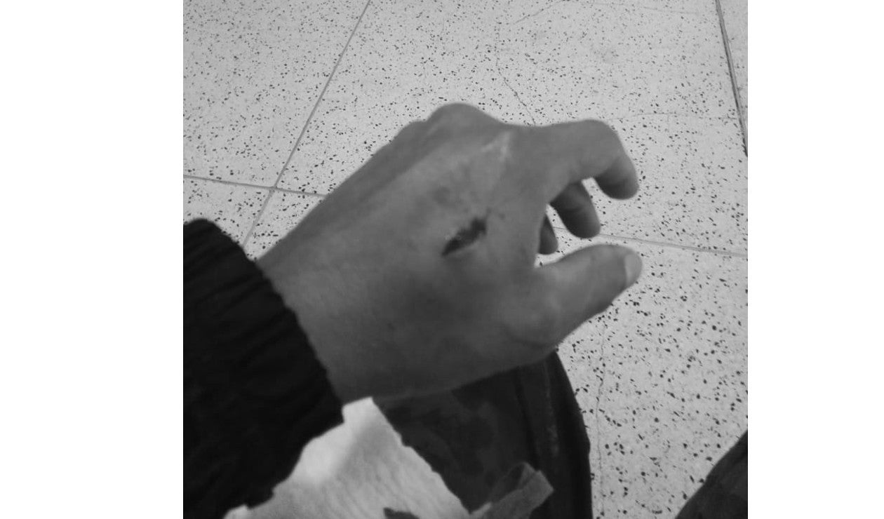 Conductor de SITP herido