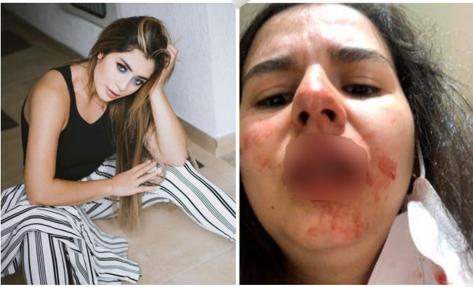 Rafaella, hija de Marbelle, habría golpeado a una joven