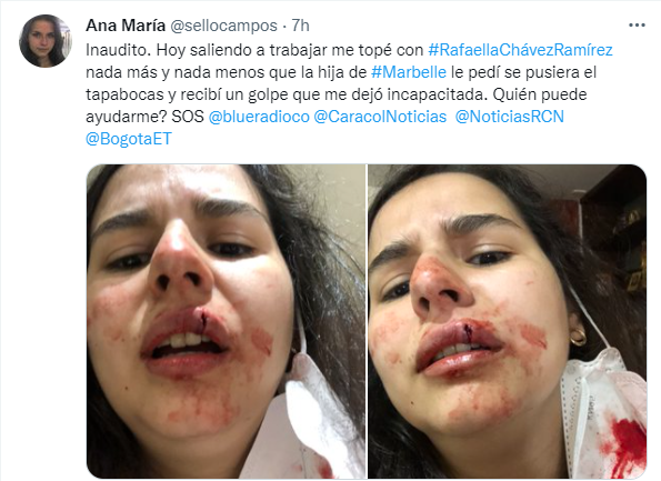 Denuncia a hija de Marbelle