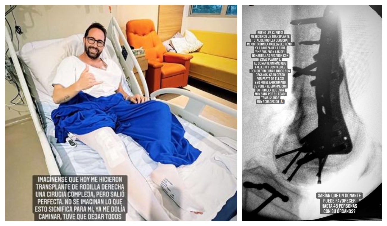 Cirugía de Lucas Arnau, sometido a trasplante de rodilla