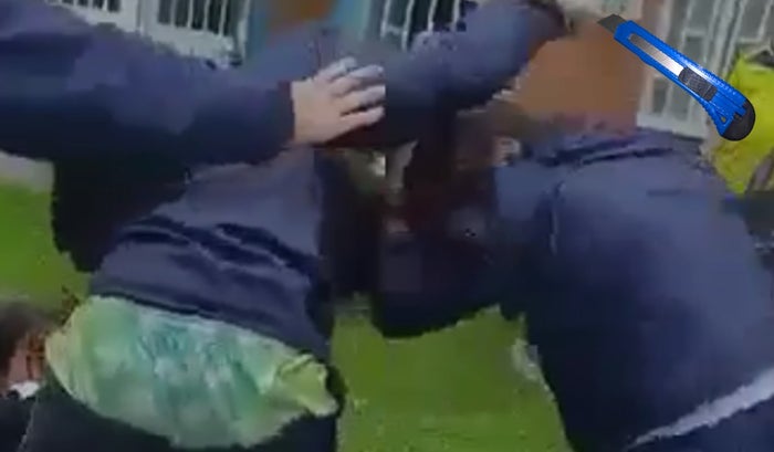 Niña le rayó la cara con bisturie a compañera del colegio