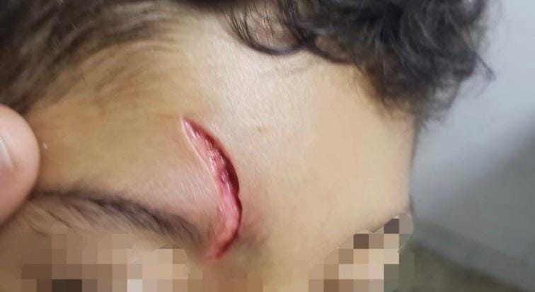 Estudiante resulto herido en el colegio