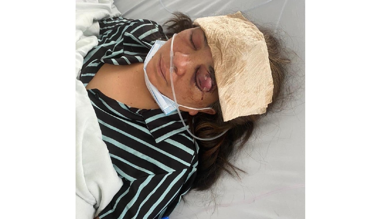 Mujer atacada con alicate y tijeras