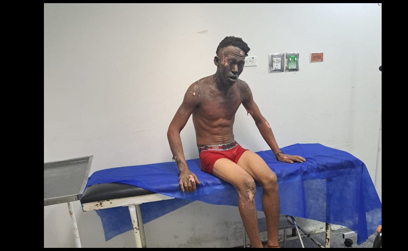 Sujeto se electrocuta robando fibra óptica en Barranquilla