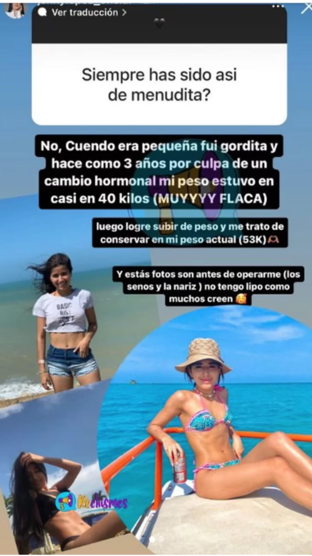 Jenny López, novia de Jhonny Rivera: así se veía antes de las cirugías