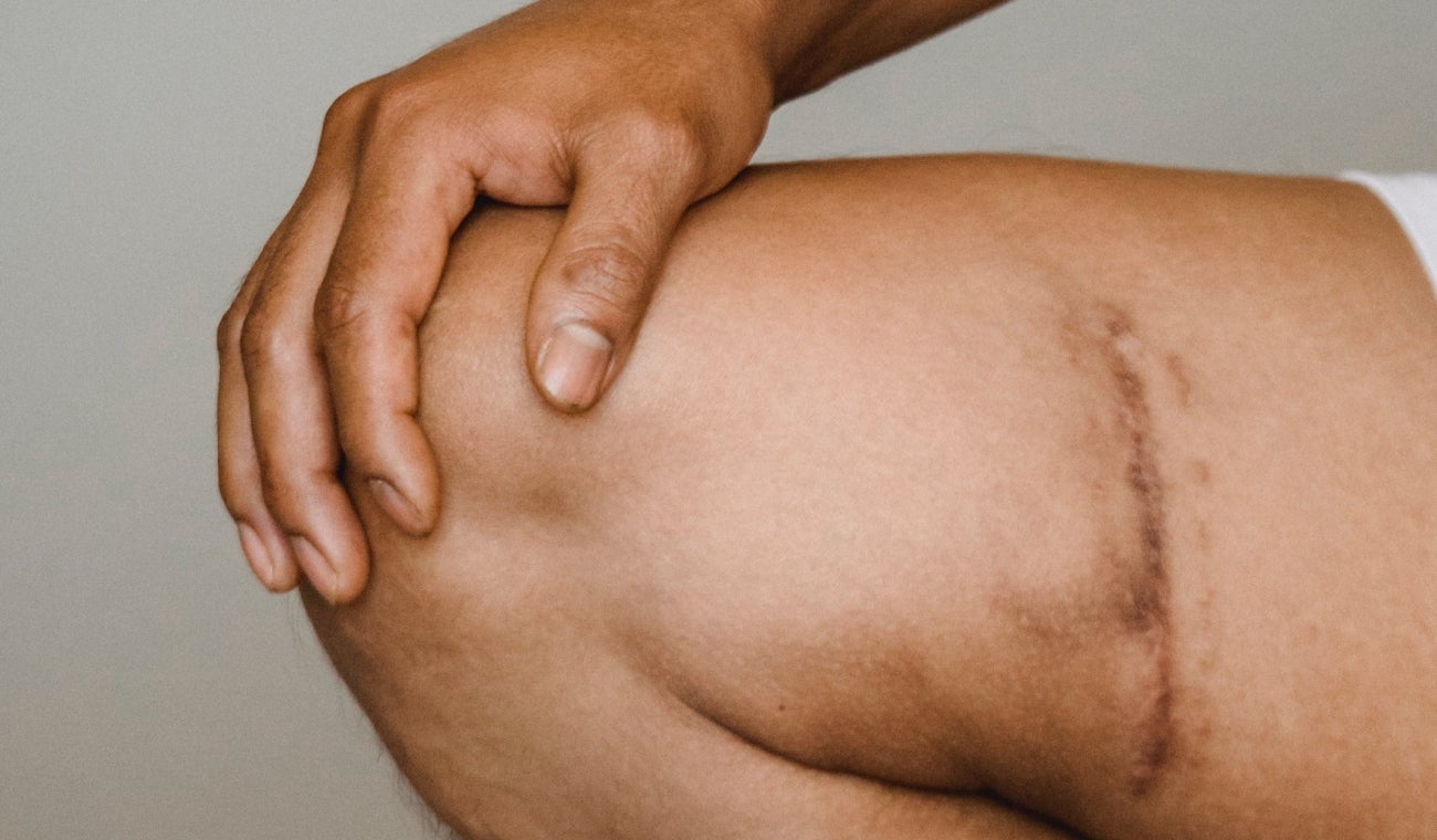 Fue a terapia de rodilla y terminó muerto en Bogotá