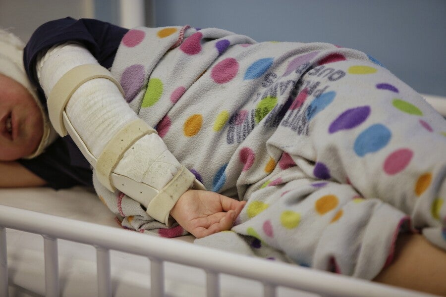 Quemados con pólvora en Colombia