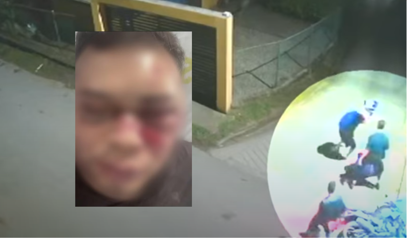 Golpiza a músico en Cundinamarca