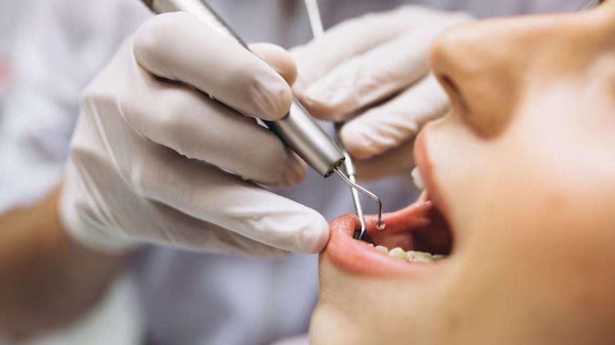 ¿Cómo saber que le calzaron mal una muela? Preste atención a estos síntomas