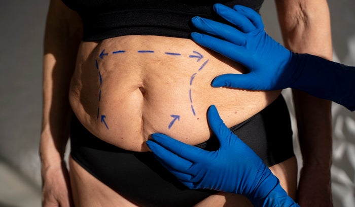 Condena por procedimiento estético que terminó con muerte de paciente