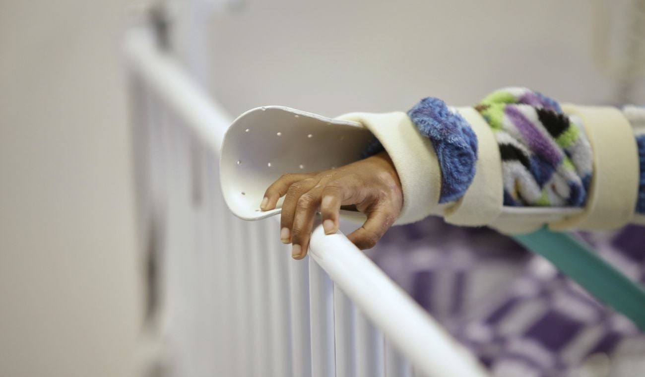 Quemados con pólvora