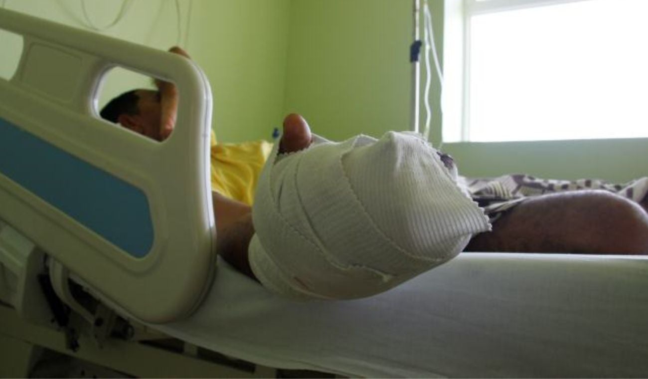 Quemados por uso de pólvora