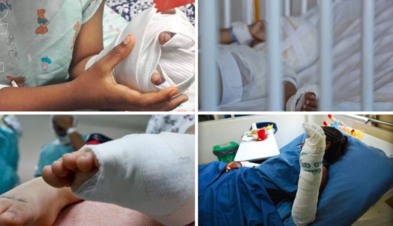 92 heridos por pólvora en Bogotá este fin de año: Engativá y Suba lideran cifras