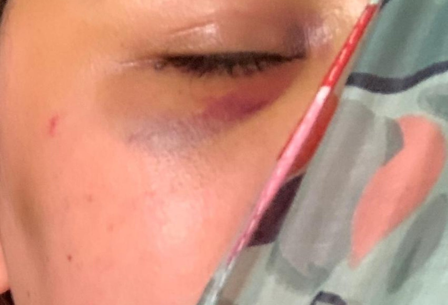 Autoridades colombianas están al tanto de la agresión a Katherine Villegas y Linda Villegas.