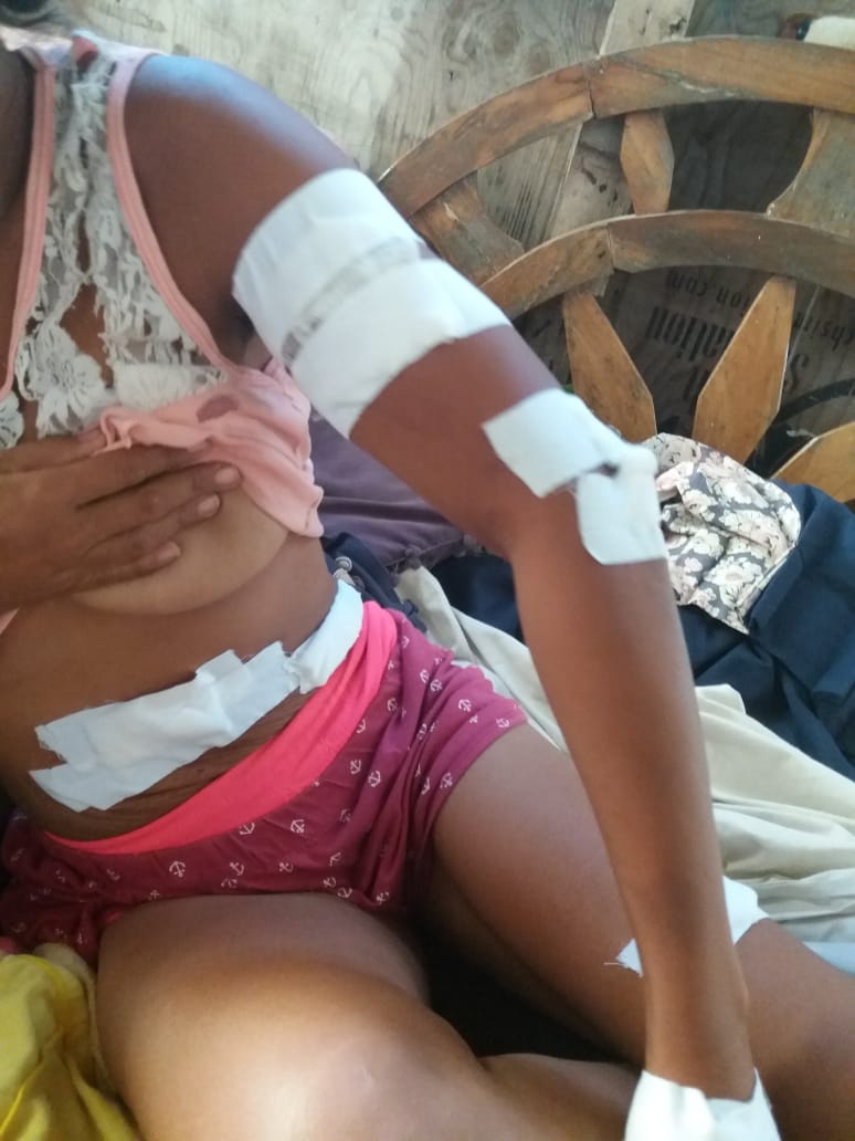 Por poco se la bajan, mientras que su esposo llevó la peor parte. Está grave