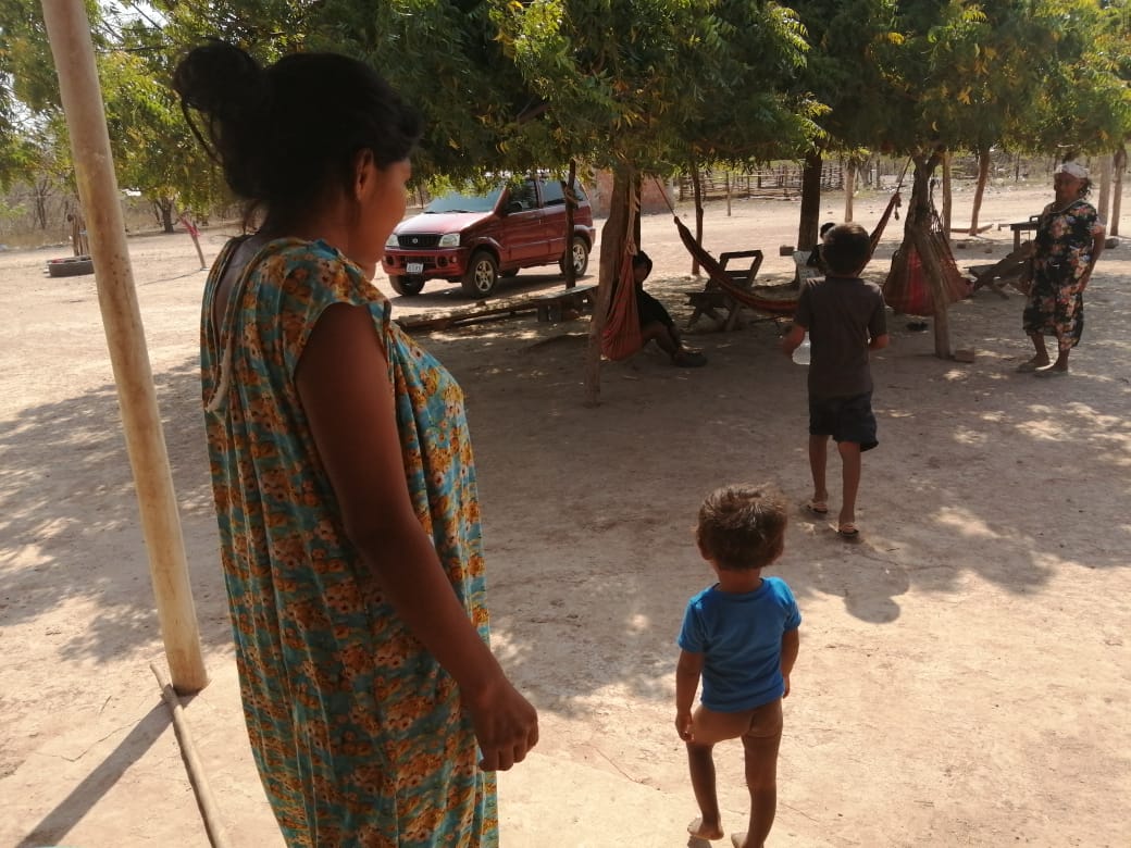 Niños con desnutrición en La Guajira