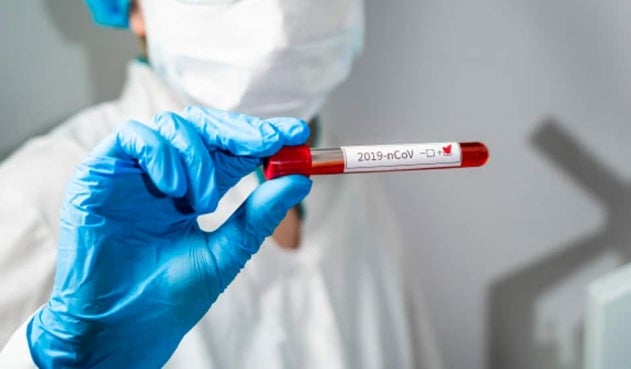 Imagen de referencia.