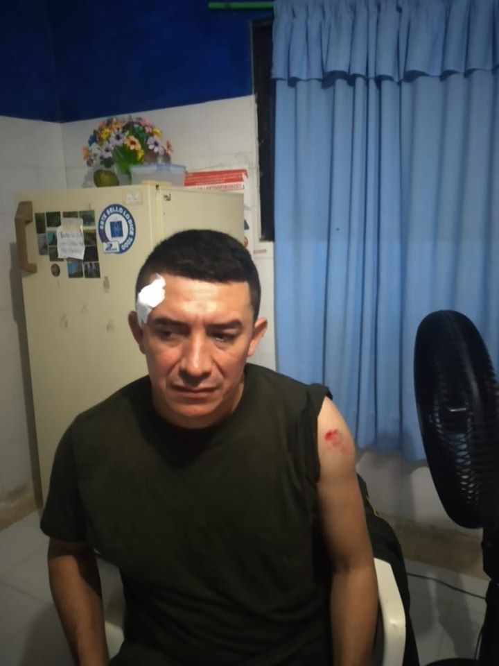 Patrullero herido, luego de confrontación con personas en una fiesta.