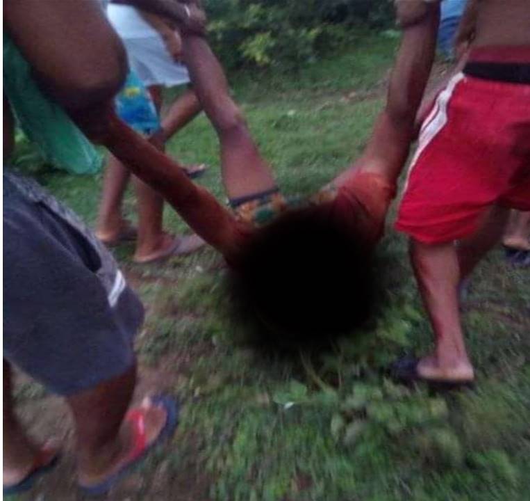 Recibió múltiples heridas en la cabeza, extremidades superiores e inferiores y región dorsal