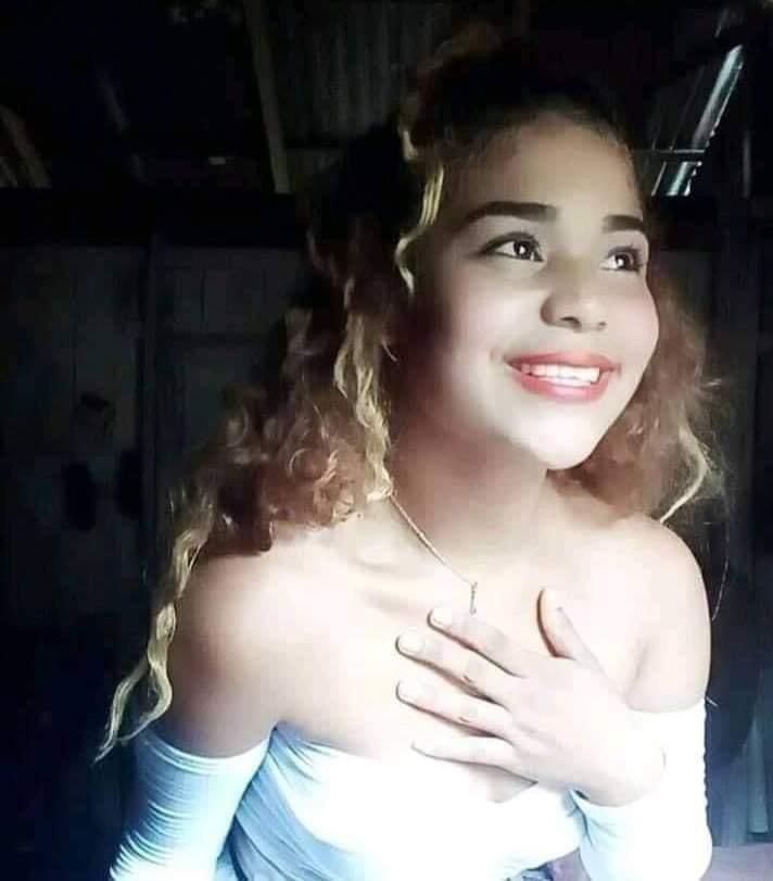 El cuerpo de la menor quedó con quemaduras de segundo y tercer grado