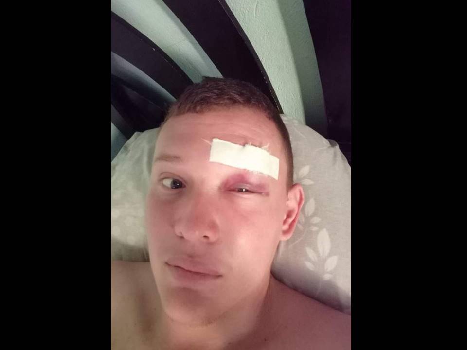 El caso ocurrió en el corregimiento El Hobo, jurisdicción de El Carmen de Bolívar