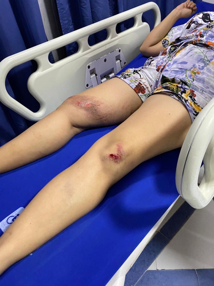 Mujer atemorizada en Cartagena