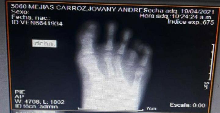 Falta de atención médica en Cartagena