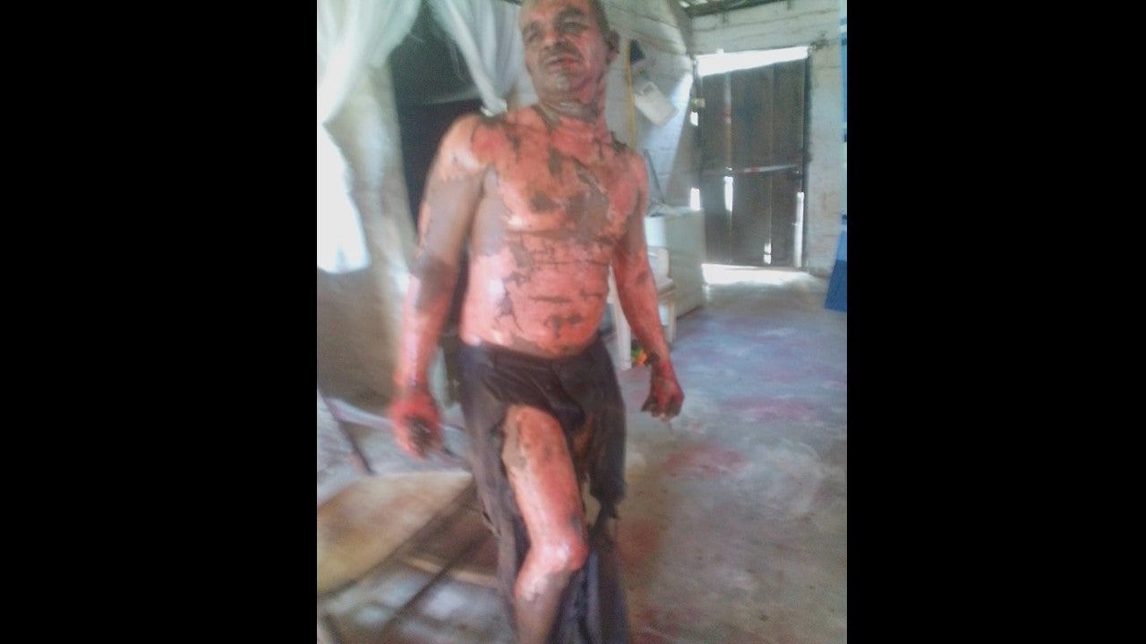 Le habrían rociado gasolina para prenderle fuego