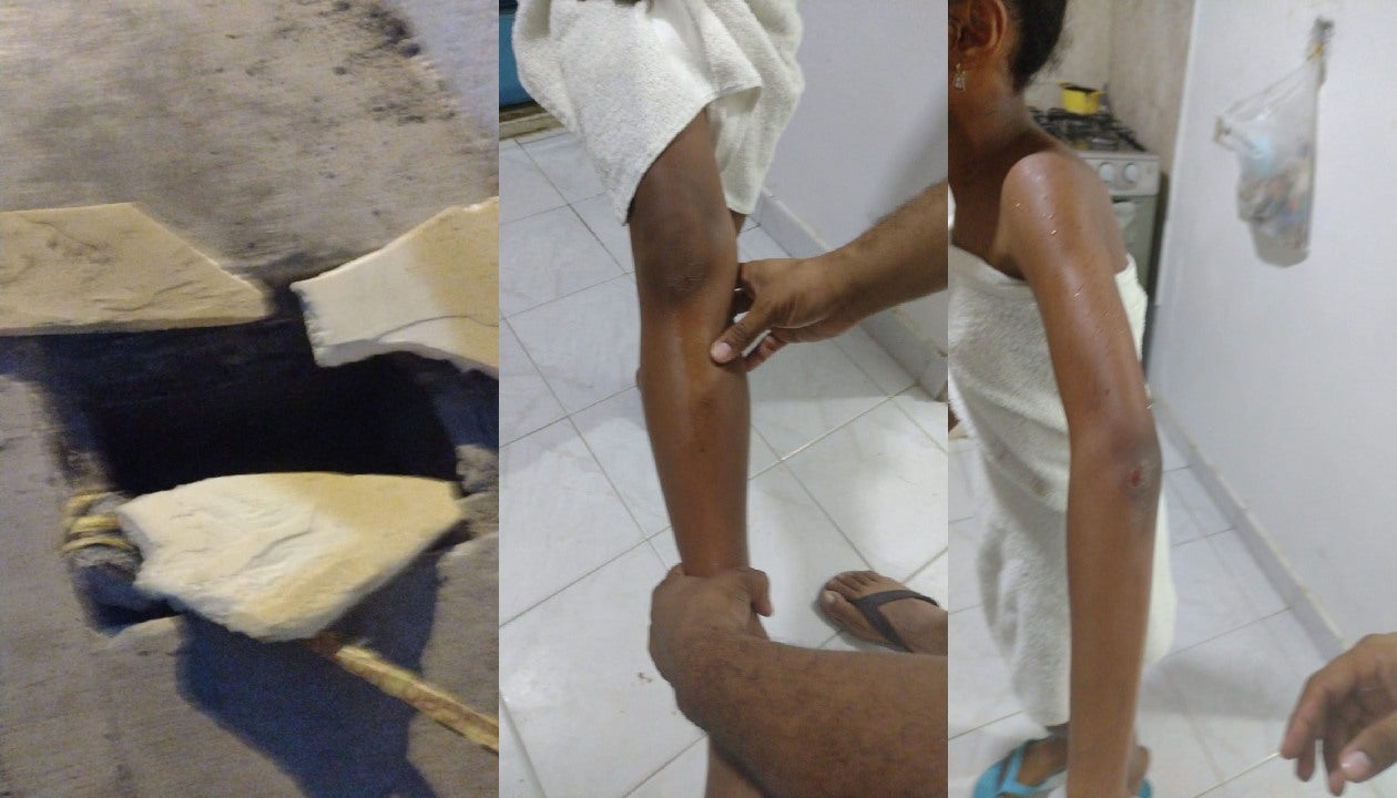 Sufrió varios golpes y laceraciones