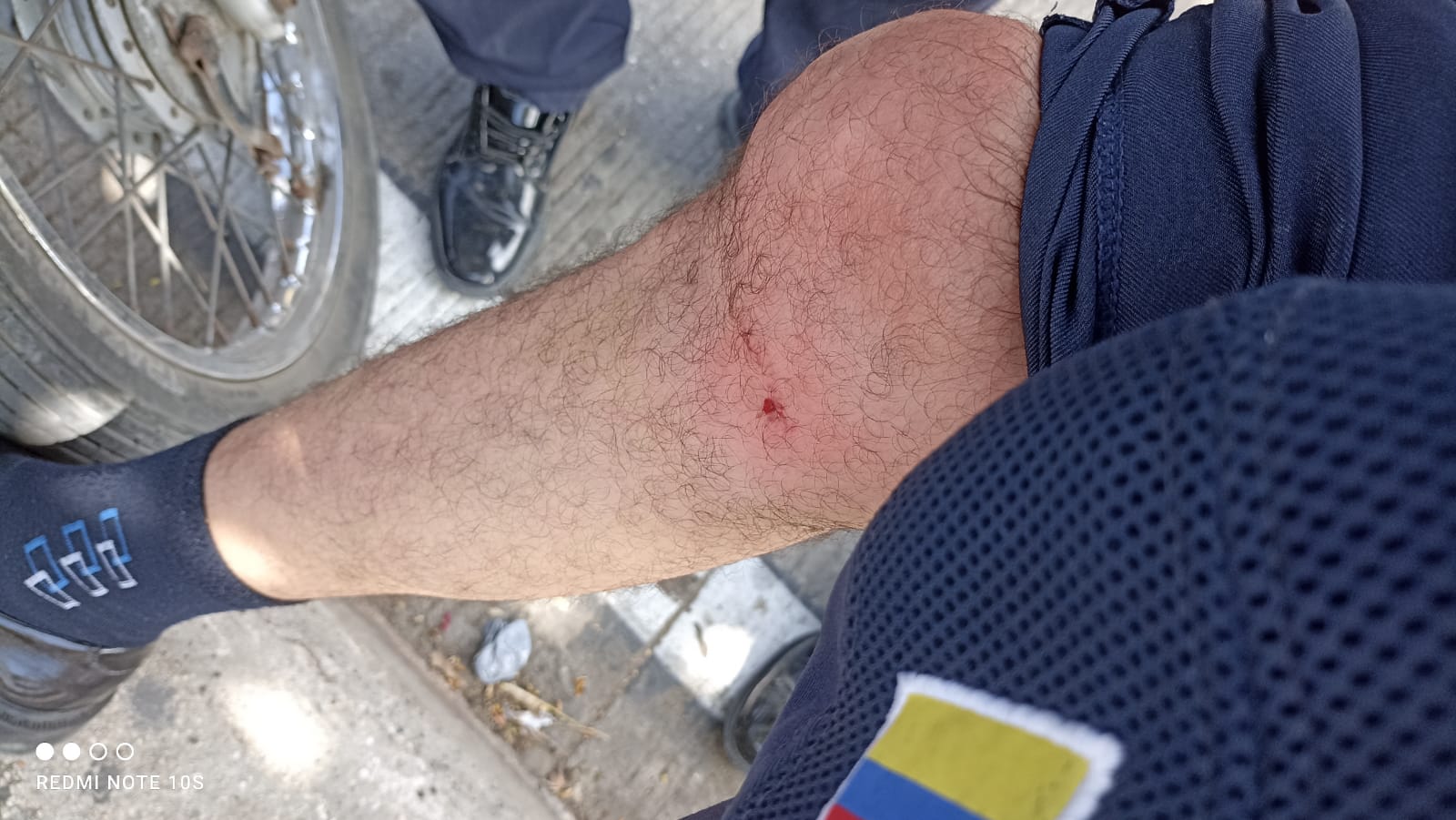 Tránsito de Cartagena fue atacado con piedras