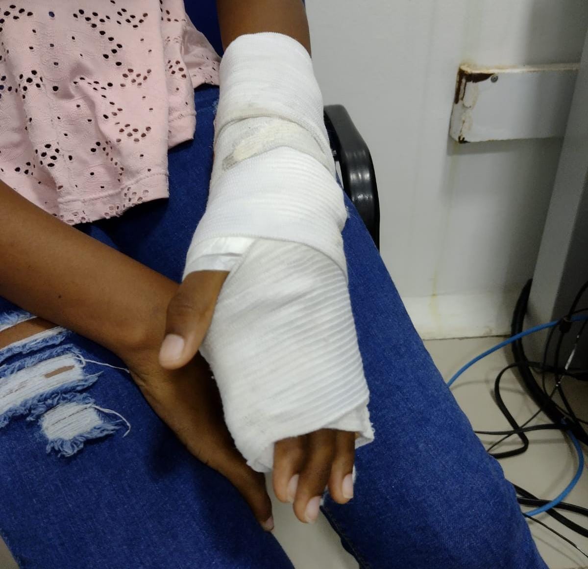 Joven que se fracturó en una actividad realizada en la Universidad