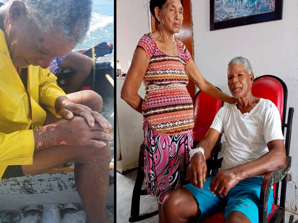 Los más de 50 años en su arte fueron su mayor apoyo para sobrevivir