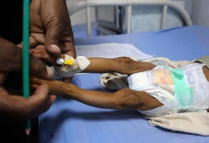 Desnutrición en Atlántico